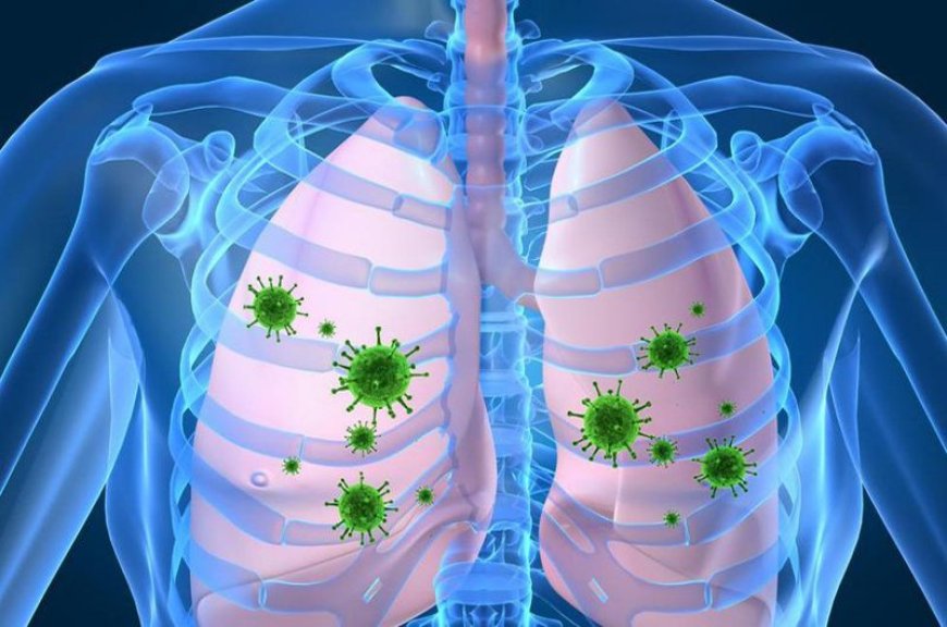 Viêm phổi: Cách chẩn đoán và điều trị